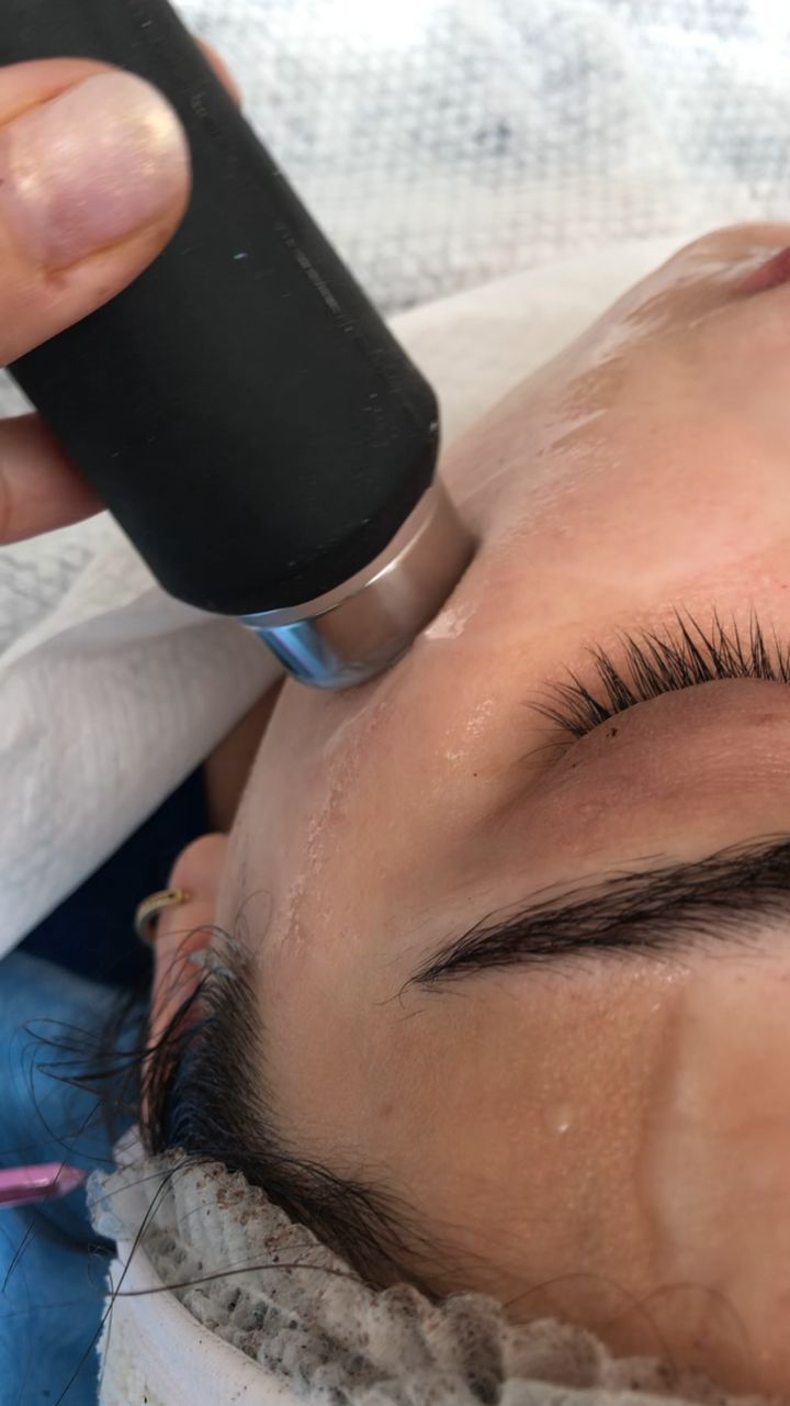 انواع فیشال